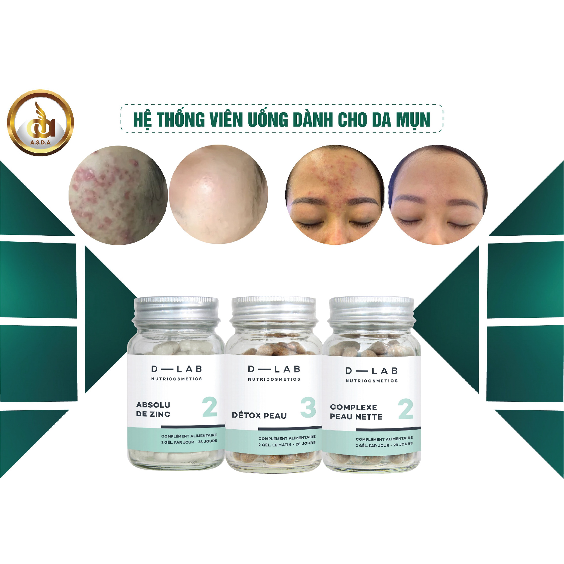 Dòng uống điều trị mụn