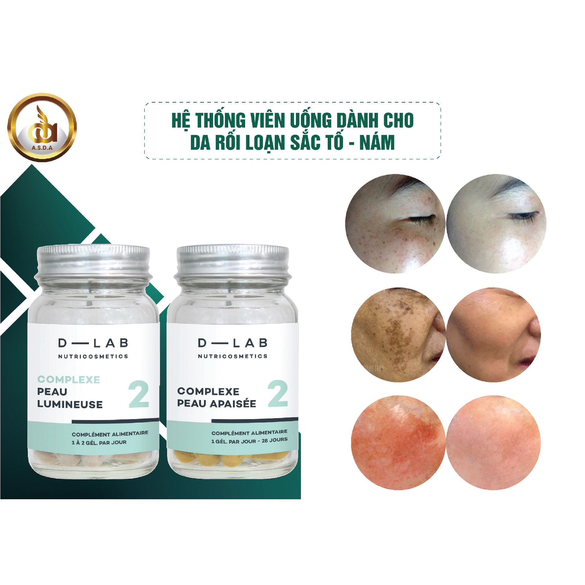 Dòng uống điều trị nám