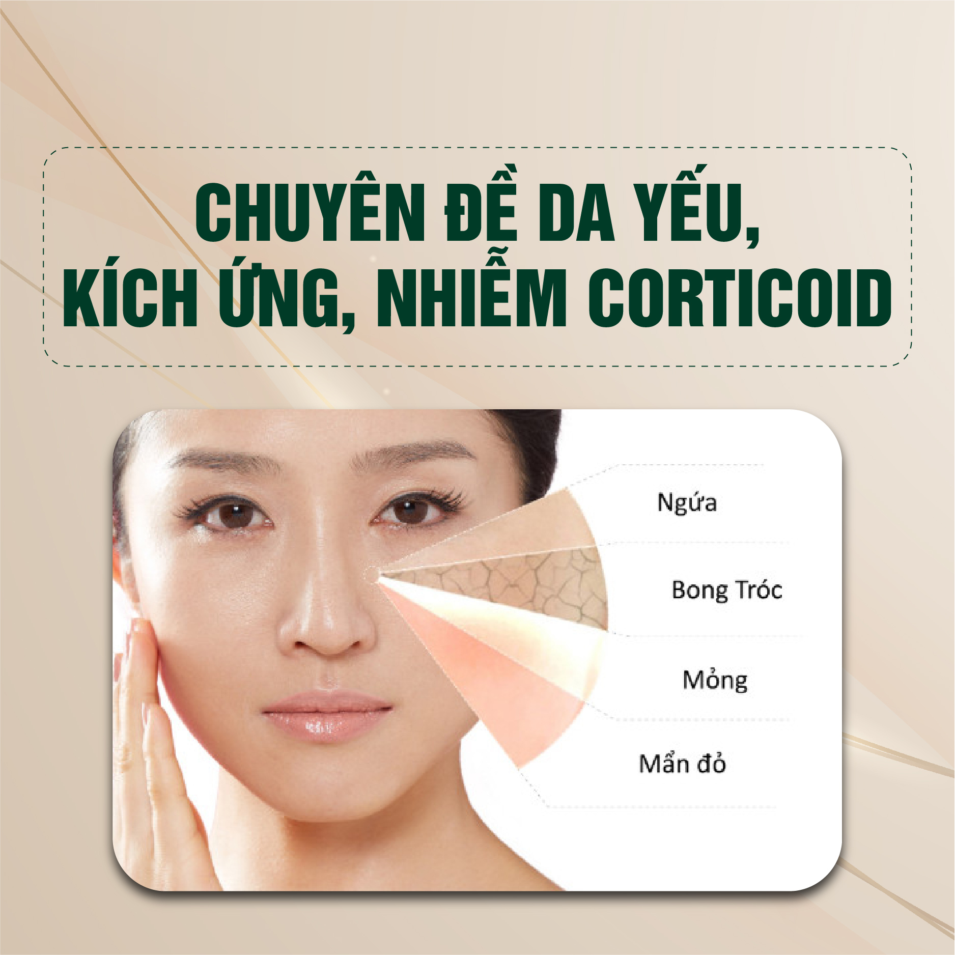 Chuyên đề da yếu, kích ứng, nhiễm corticoid